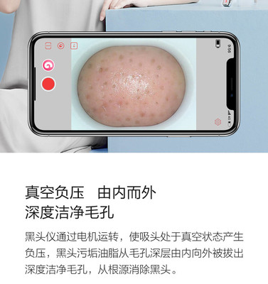小米有品媄拾智能可視吸黑頭儀 告別黑頭，開啟“眼見為實”的清潔新時代